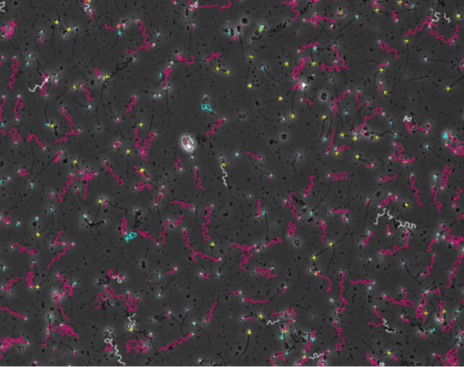 SMASで解析した精子画像