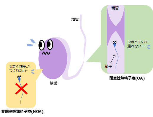 閉塞性無精子症と非閉塞性無精子症 スタッフブログ 桜十字渋谷バースクリニック